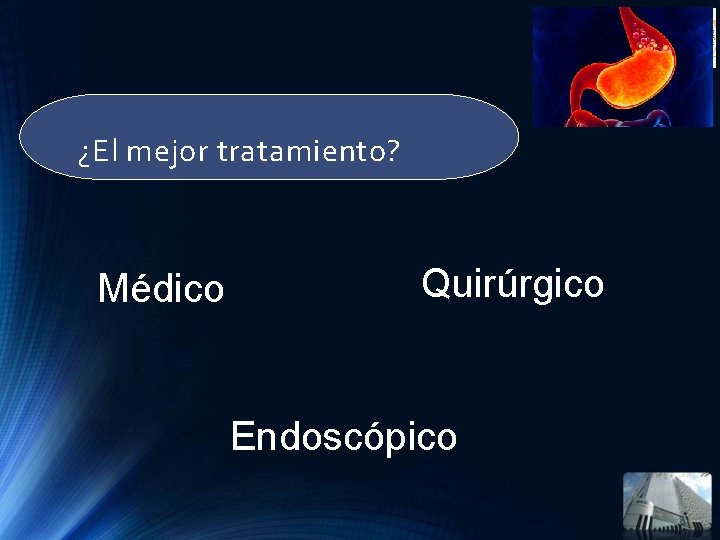 ¿El mejor tratamiento? Médico Quirúrgico Endoscópico ¿El mejor tratamiento? Médico Quirúrgico Endoscópico