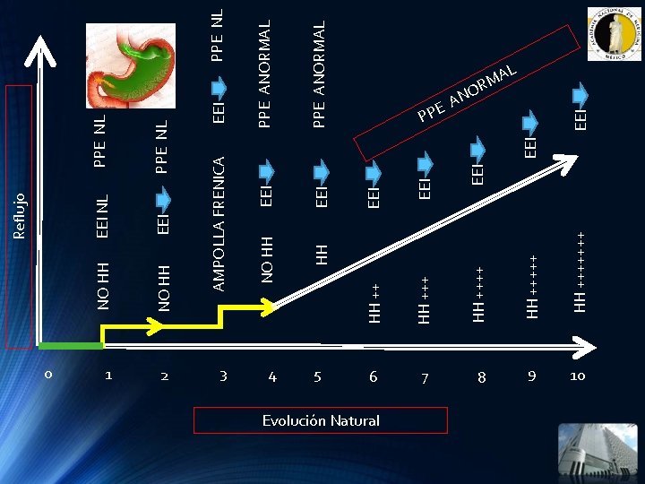 2 3 4 Evolución Natural HH +++++++ EEI EEI HH HH +++ 5 HH 2 3 4 Evolución Natural HH +++++++ EEI EEI HH HH +++ 5 HH