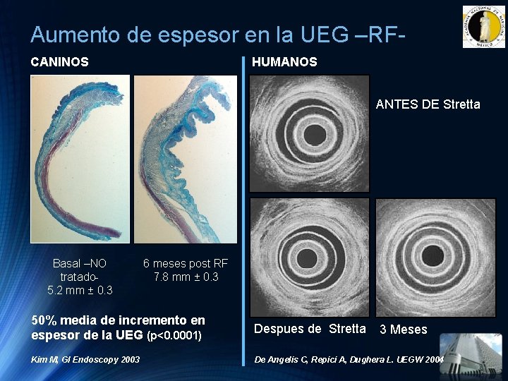 Aumento de espesor en la UEG –RFCANINOS HUMANOS ANTES DE Stretta Basal –NO tratado Aumento de espesor en la UEG –RFCANINOS HUMANOS ANTES DE Stretta Basal –NO tratado
