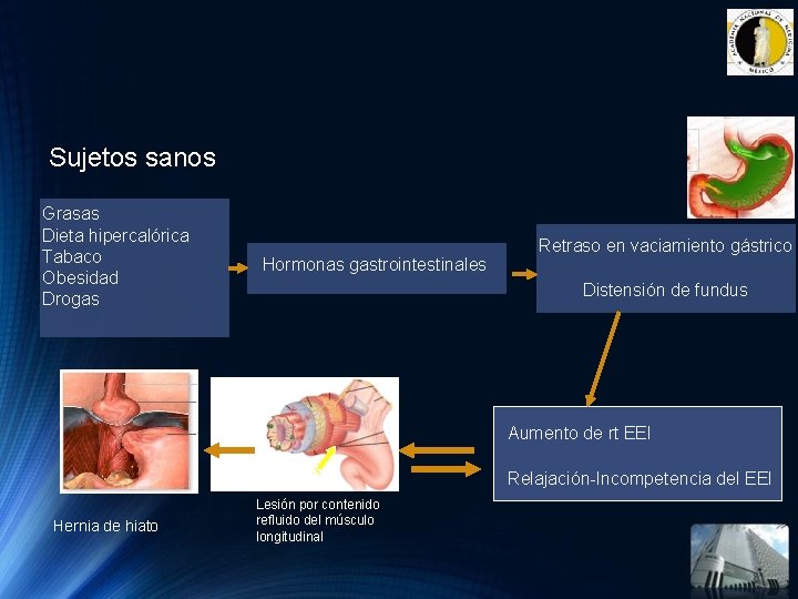 Sujetos sanos Grasas Dieta hipercalórica Tabaco Obesidad Drogas Hormonas gastrointestinales Retraso en vaciamiento gástrico Sujetos sanos Grasas Dieta hipercalórica Tabaco Obesidad Drogas Hormonas gastrointestinales Retraso en vaciamiento gástrico
