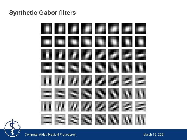 Synthetic Gabor filters Computer Aided Medical Procedures March 12, 2021 
