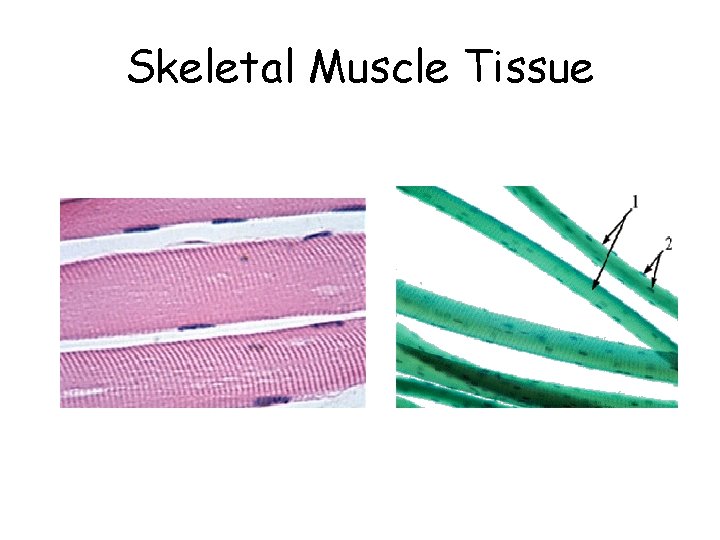 Skeletal Muscle Tissue 