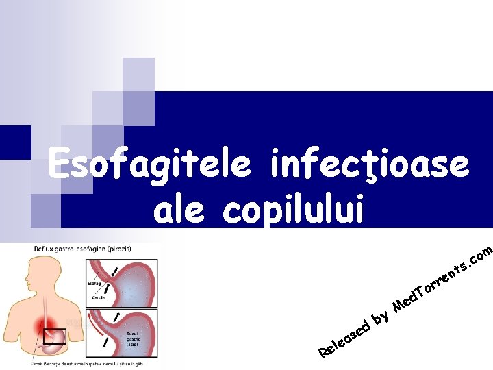 Esofagitele infecţioase ale copilului d le Re e as e M by r o