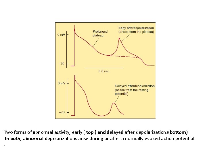 Two forms of abnormal activity, early ( top ) and delayed after depolarizations(bottom) In