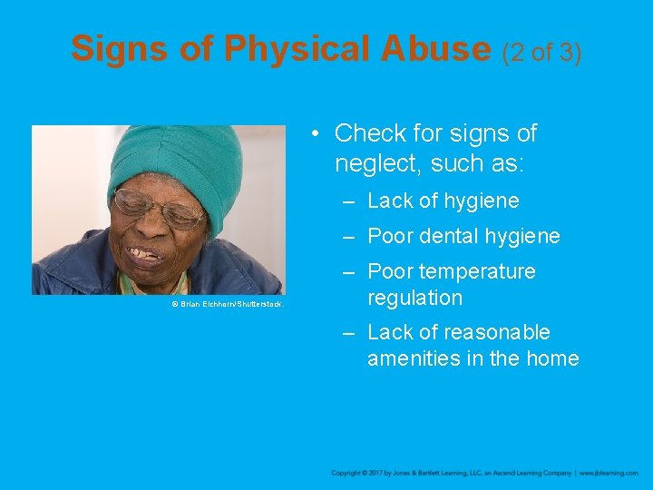 Signs of Physical Abuse (2 of 3) • Check for signs of neglect, such