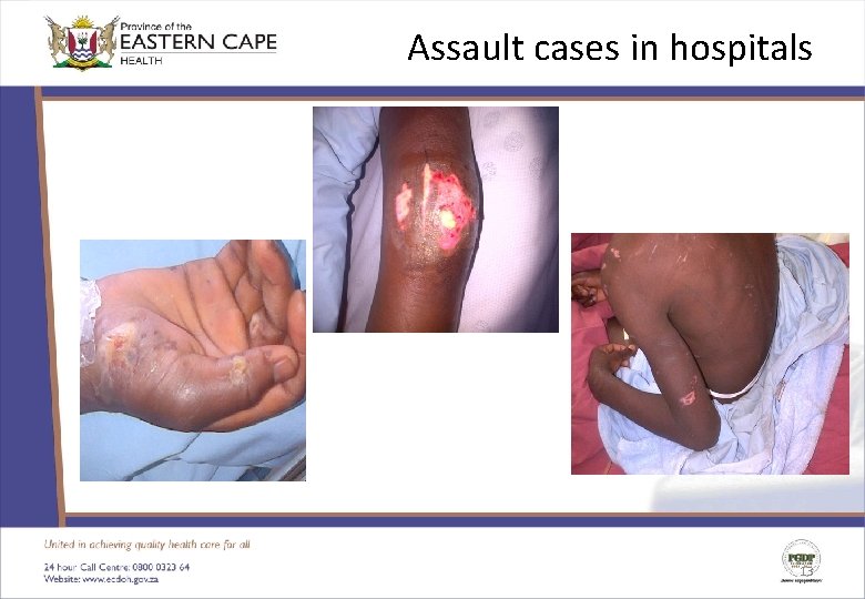 Assault cases in hospitals 13 