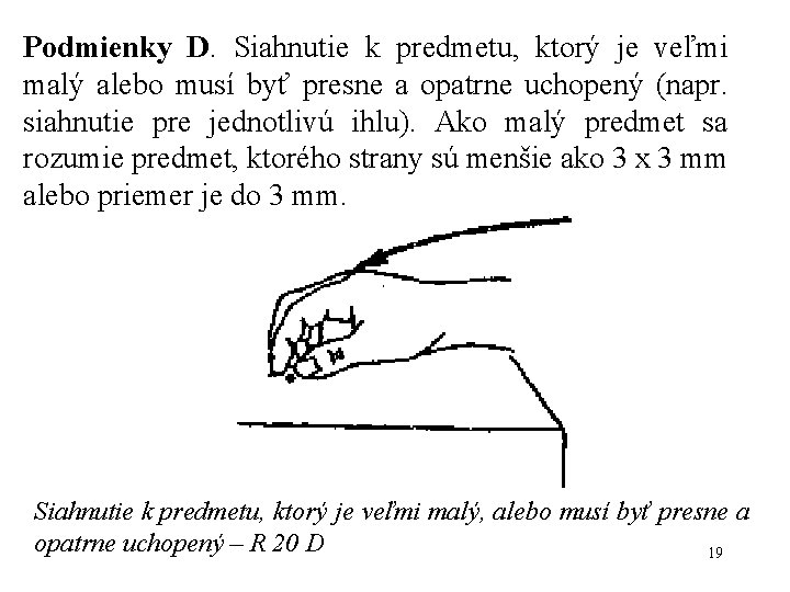 Podmienky D. Siahnutie k predmetu, ktorý je veľmi malý alebo musí byť presne a Podmienky D. Siahnutie k predmetu, ktorý je veľmi malý alebo musí byť presne a