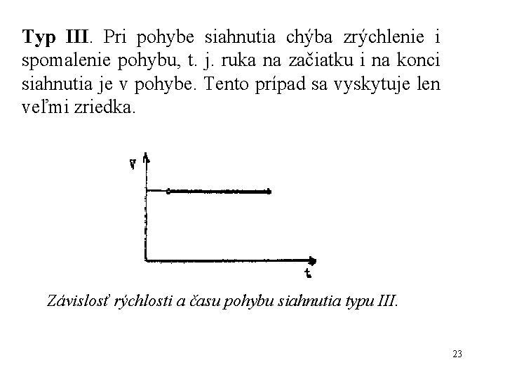 Typ III. Pri pohybe siahnutia chýba zrýchlenie i spomalenie pohybu, t. j. ruka na Typ III. Pri pohybe siahnutia chýba zrýchlenie i spomalenie pohybu, t. j. ruka na