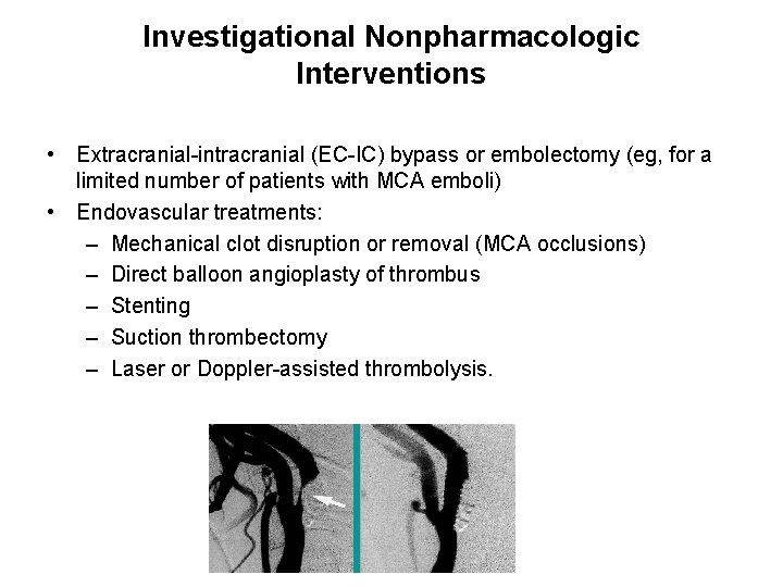 Investigational Nonpharmacologic Interventions • Extracranial-intracranial (EC-IC) bypass or embolectomy (eg, for a limited number