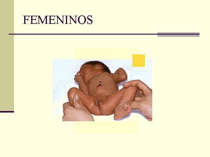 FEMENINOS 
