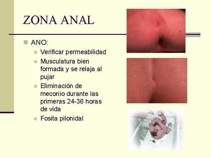 ZONA ANAL n ANO: n Verificar permeabilidad n Musculatura bien formada y se relaja