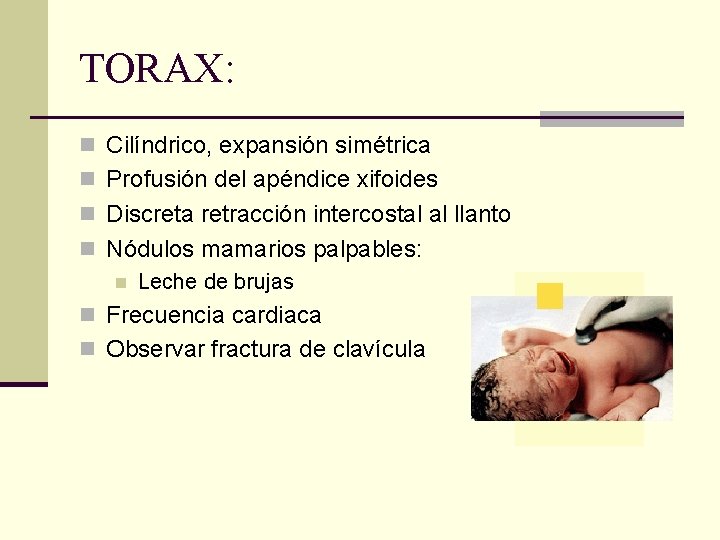 TORAX: n Cilíndrico, expansión simétrica n Profusión del apéndice xifoides n Discreta retracción intercostal