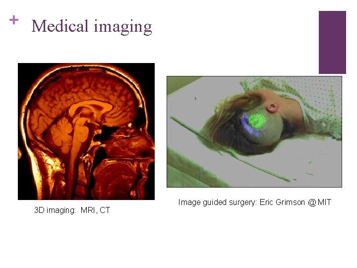 + Medical imaging 3 D imaging: MRI, CT Image guided surgery: Eric Grimson @
