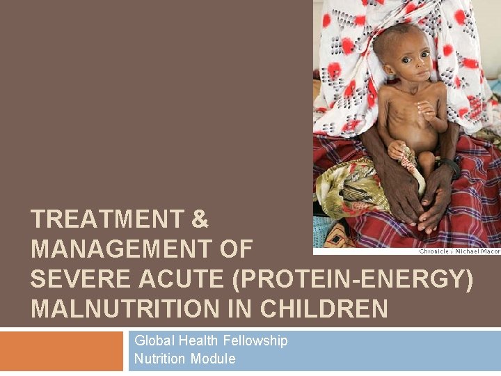 TREATMENT & MANAGEMENT OF SEVERE ACUTE (PROTEIN-ENERGY) MALNUTRITION IN CHILDREN Global Health Fellowship Nutrition