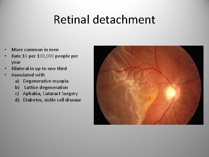 Retinal detachment • More common in men • Rate 10 per 100, 000 people