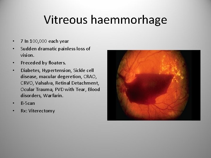 Vitreous haemmorhage • • • 7 In 100, 000 each year Sudden dramatic painless