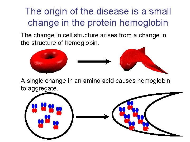 The origin of the disease is a small change in the protein hemoglobin The