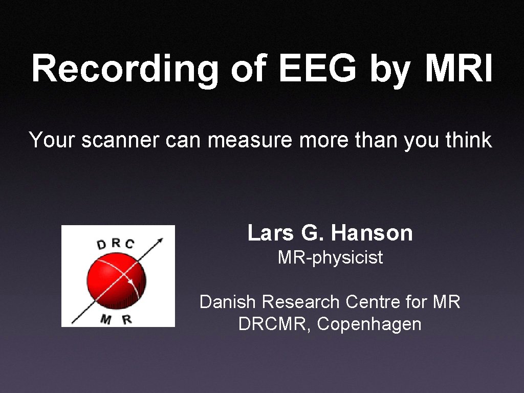 Recording of EEG by MRI Your scanner can measure more than you think Lars