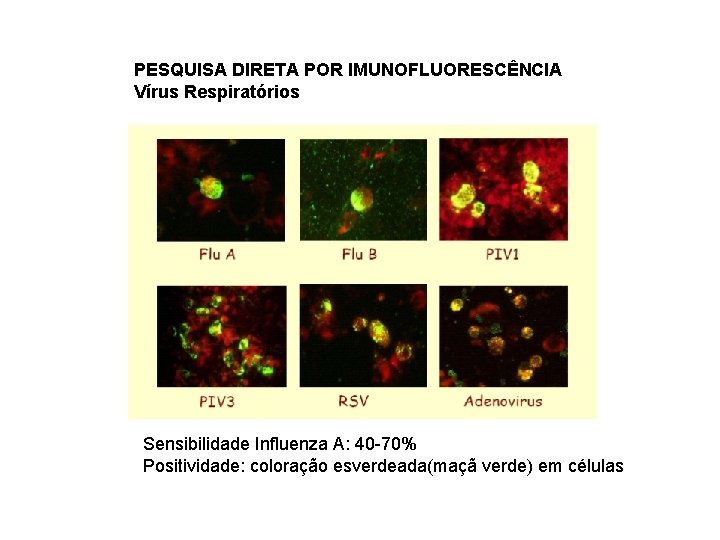 PESQUISA DIRETA POR IMUNOFLUORESCÊNCIA Vírus Respiratórios Sensibilidade Influenza A: 40 -70% Positividade: coloração esverdeada(maçã