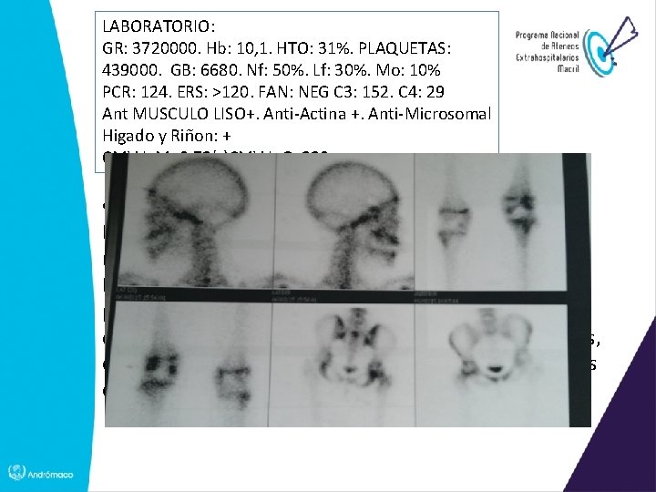 LABORATORIO: GR: 3720000. Hb: 10, 1. HTO: 31%. PLAQUETAS: 439000. GB: 6680. Nf: 50%.