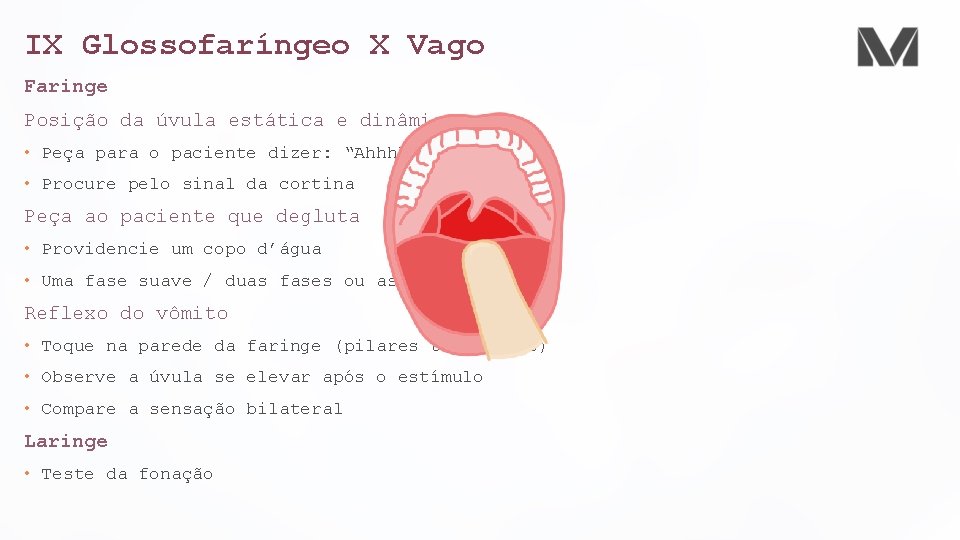 IX Glossofaríngeo X Vago Faringe Posição da úvula estática e dinâmica • Peça para