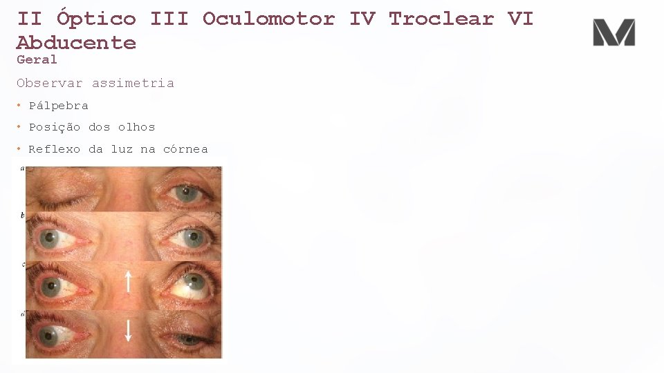 II Óptico III Oculomotor IV Troclear VI Abducente Geral Observar assimetria • Pálpebra •