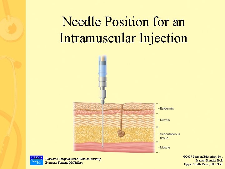 Needle Position for an Intramuscular Injection Pearson’s Comprehensive Medical Assisting Beaman / Fleming-Mc. Phillips