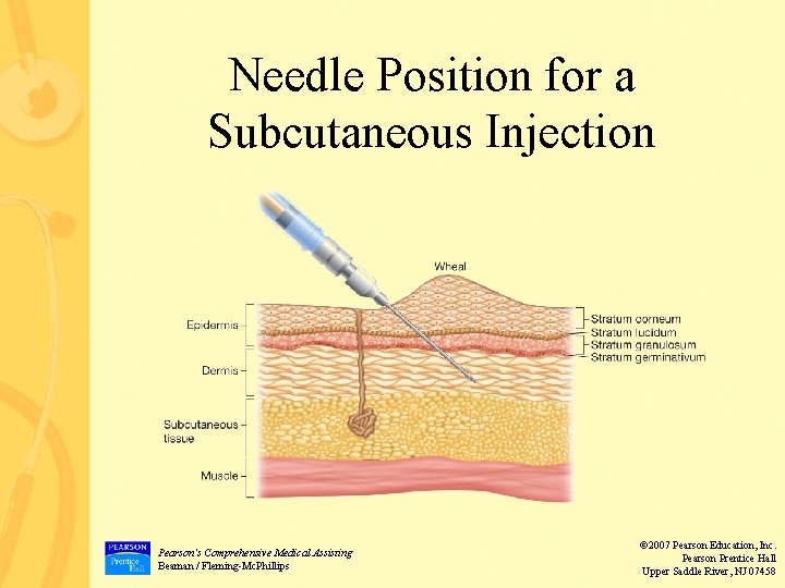 Needle Position for a Subcutaneous Injection Pearson’s Comprehensive Medical Assisting Beaman / Fleming-Mc. Phillips