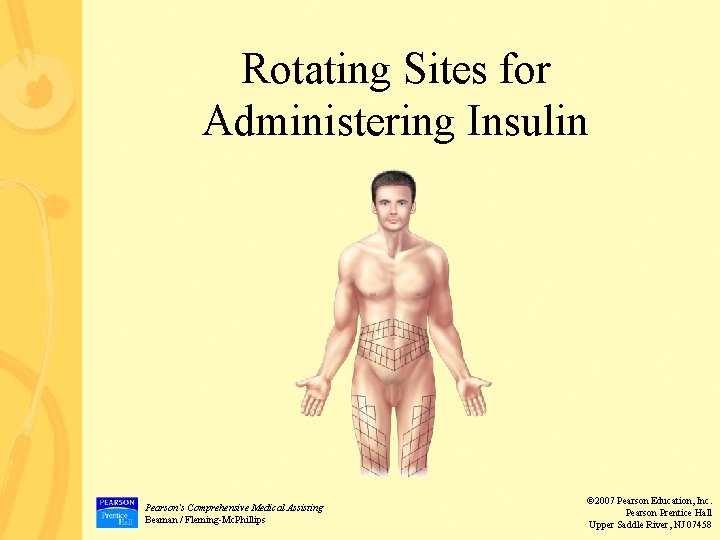 Rotating Sites for Administering Insulin Pearson’s Comprehensive Medical Assisting Beaman / Fleming-Mc. Phillips © Rotating Sites for Administering Insulin Pearson’s Comprehensive Medical Assisting Beaman / Fleming-Mc. Phillips ©