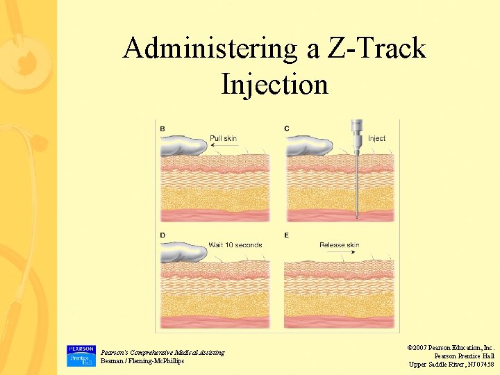 Administering a Z-Track Injection Pearson’s Comprehensive Medical Assisting Beaman / Fleming-Mc. Phillips © 2007