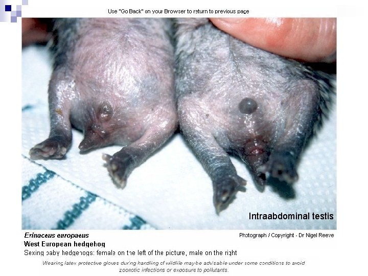 Intraabdominal testis 