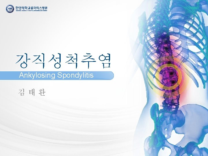 강직성척추염 Ankylosing Spondylitis 김태환 