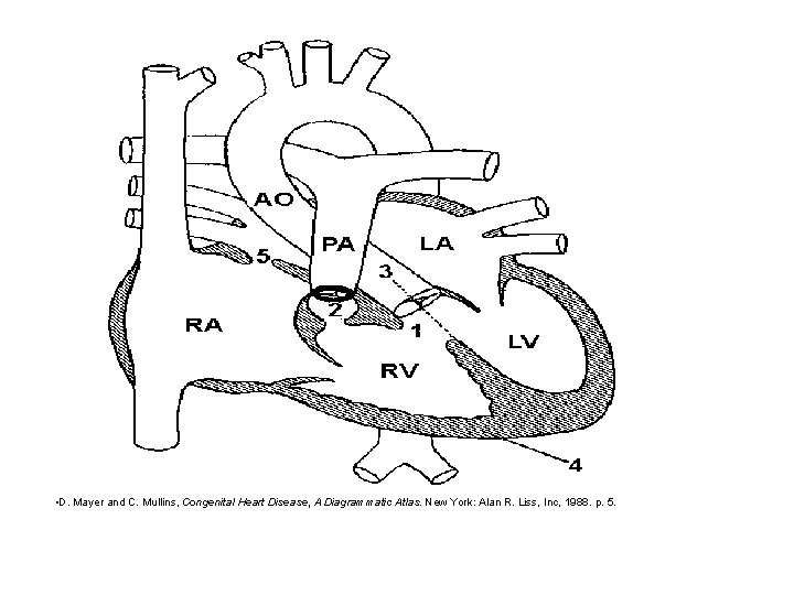  • D. Mayer and C. Mullins, Congenital Heart Disease, A Diagrammatic Atlas. New