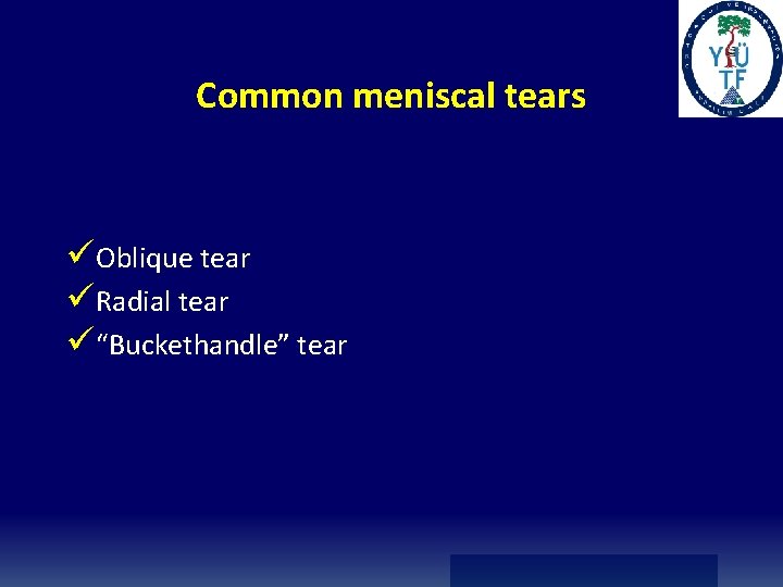 Common meniscal tears üOblique tear üRadial tear ü“Buckethandle” tear Common meniscal tears üOblique tear üRadial tear ü“Buckethandle” tear