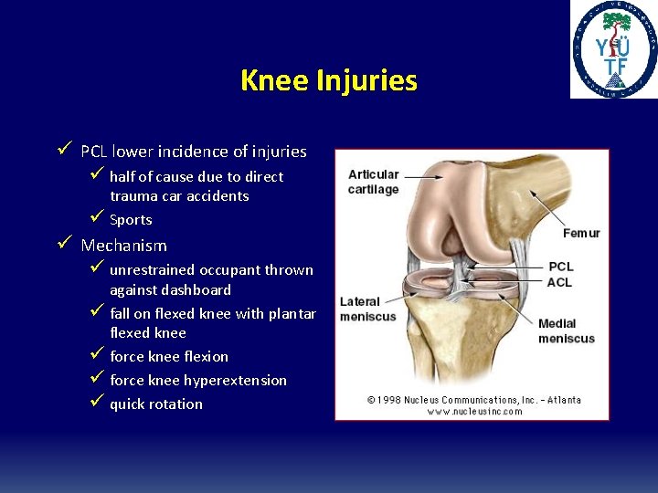 Knee Injuries ü PCL lower incidence of injuries ü half of cause due to Knee Injuries ü PCL lower incidence of injuries ü half of cause due to