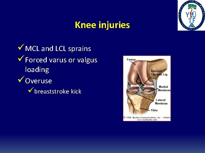 Knee injuries üMCL and LCL sprains üForced varus or valgus loading üOveruse übreaststroke kick Knee injuries üMCL and LCL sprains üForced varus or valgus loading üOveruse übreaststroke kick