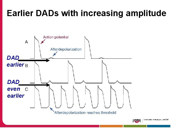 Earlier DADs with increasing amplitude DAD earlier DAD even earlier 