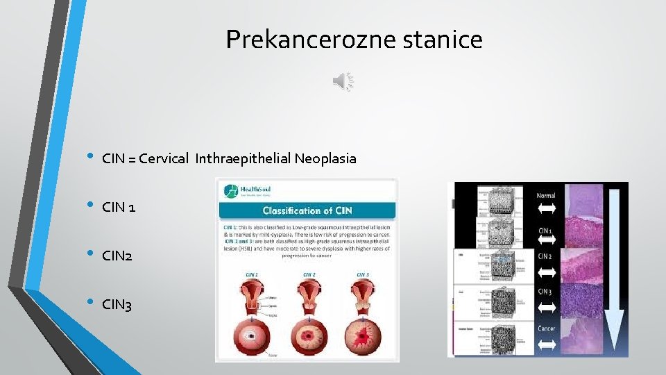 Prekancerozne stanice • CIN = Cervical Inthraepithelial Neoplasia • CIN 1 • CIN 2