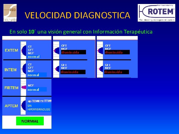 VELOCIDAD DIAGNOSTICA En solo 10´ una visión general con Información Terapéutica normal SIN HIPERFIBRINOLISIS