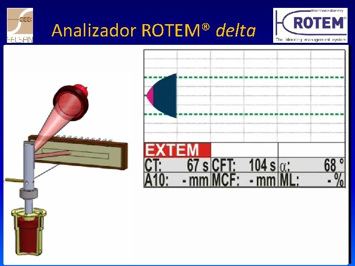 Analizador ROTEM® delta 