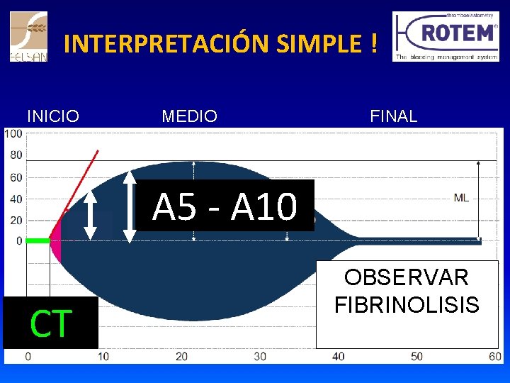 INTERPRETACIÓN SIMPLE ! INICIO MEDIO FINAL A 5 - A 10 CT OBSERVAR FIBRINOLISIS