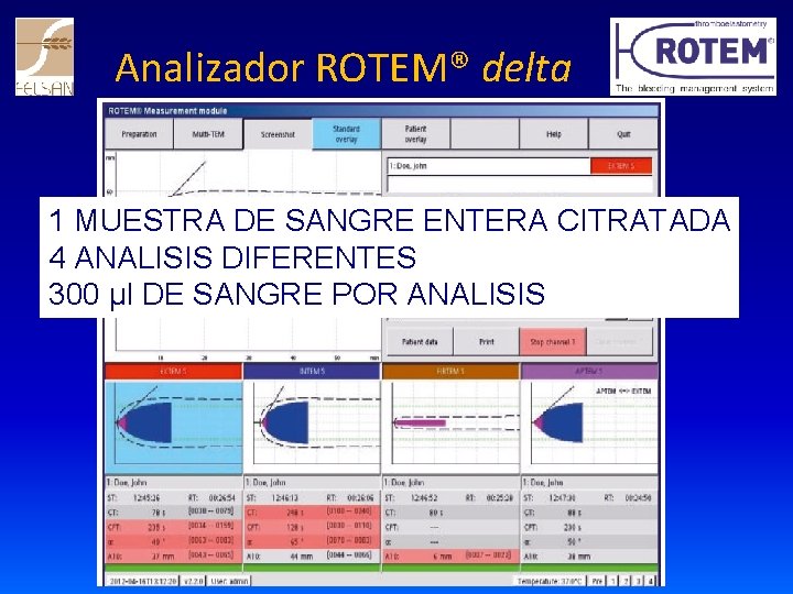 Analizador ROTEM® delta 1 MUESTRA DE SANGRE ENTERA CITRATADA 4 ANALISIS DIFERENTES 300 µl