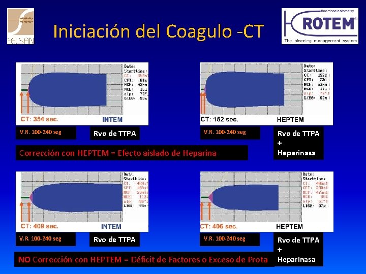Iniciación del Coagulo -CT V. R. 100 -240 seg Rvo de TTPA V. R.