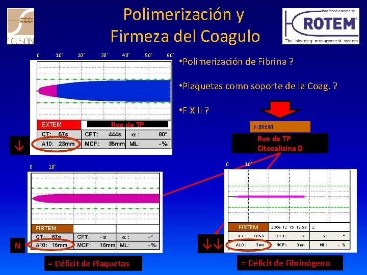 Polimerización y Firmeza del Coagulo 0 10` 20` 30` 40` 50` 60` • Polimerización