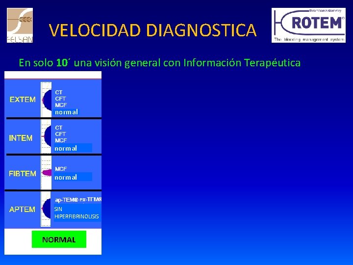 VELOCIDAD DIAGNOSTICA En solo 10´ una visión general con Información Terapéutica normal SIN HIPERFIBRINOLISIS