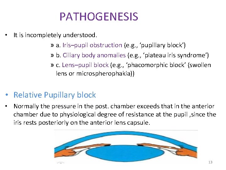 PATHOGENESIS • It is incompletely understood. » a. Iris–pupil obstruction (e. g. , ‘pupillary