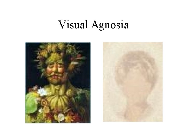 Visual Agnosia 