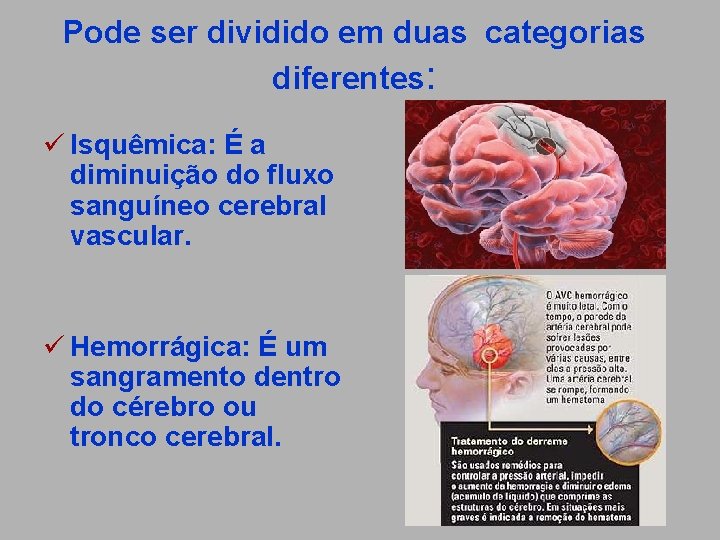 Pode ser dividido em duas categorias diferentes: ü Isquêmica: É a diminuição do fluxo