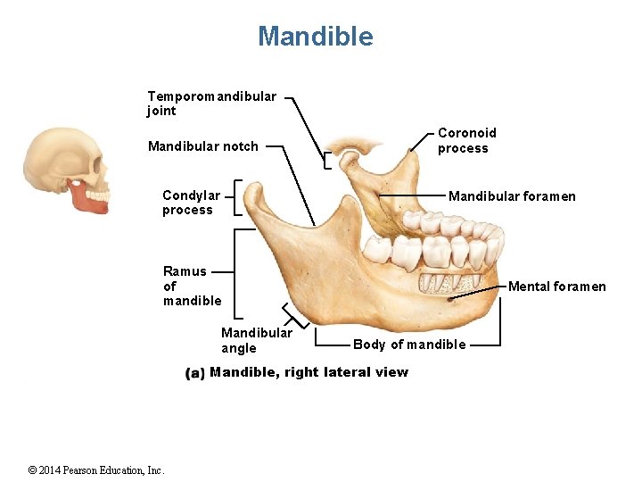 Mandible Temporomandibular joint Coronoid process Mandibular notch Condylar process Mandibular foramen Ramus of mandible