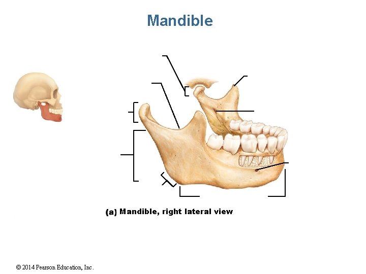 Mandible, right lateral view © 2014 Pearson Education, Inc. 